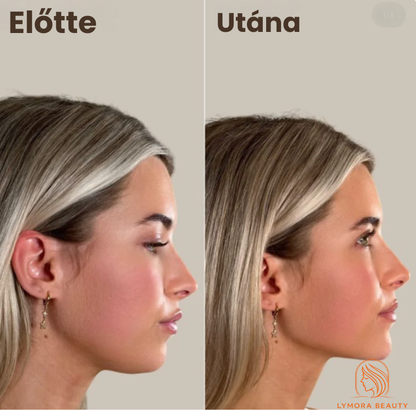 Lymora nyirokmasszázs arckontúr kefe